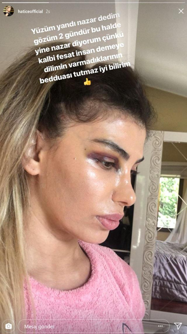 Kalçasını açarak olay olmuştu! Hatice'nin son hali korkuttu! - Resim: 3