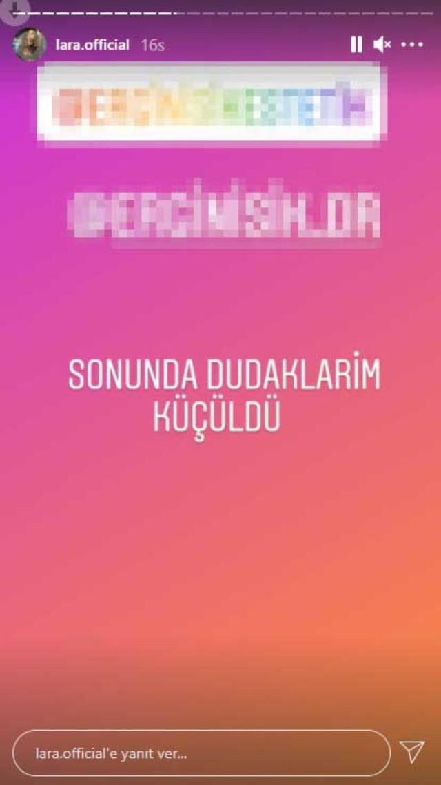 Şarkıcı Lara estetikle herkesin büyültmek istediğini küçülttü son hali bakın nasıl - Resim: 4