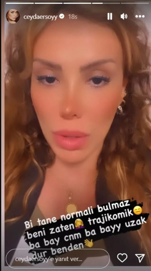 Ciciş Ceyda Ersoy'un öpüşürken dili koptu! Hastaneden olay paylaşım: "Bir ay öpüşmemiştik ama" - Resim: 0