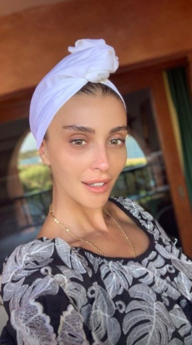 Özge Ulusoy'dan bomba estetik itirafı eski hali olay olmuştu - Resim: 2