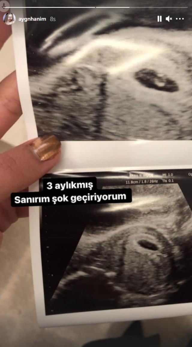 Aygün Aydın ultrason görüntüsü paylaştı bebek 3 aylık Hakan Sabancı'ya küfürler savurmuştu - Resim: 4