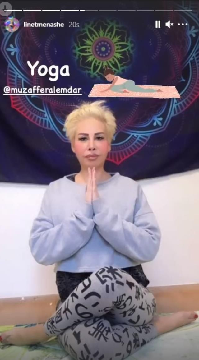 Linet'in imajı şoke etti! İbo Show'daki halinden eser kalmadı bambaşka biri gibi - Resim: 4