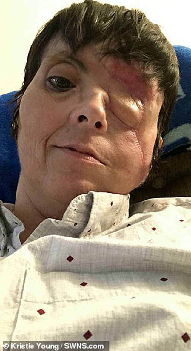 Yüzünde havai fişek patladı! Hayatı bir günde karardı - Resim: 4