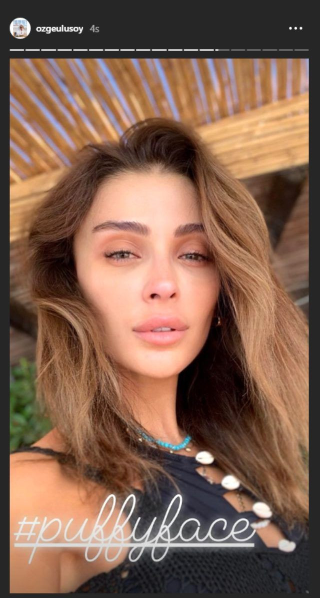 Özge Ulusoy makyajsız haliyle herkesi şaşırttı güzelliği büyüledi - Resim: 2