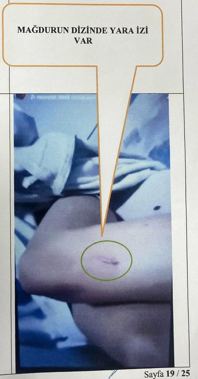 Konya'da mide bulandıran olay! Masaj salonu çalışanı genç kız kabusu yaşadı: Önce içkisine ilaç koydular sonra sırayla tecavüz ettiler! - Resim: 3