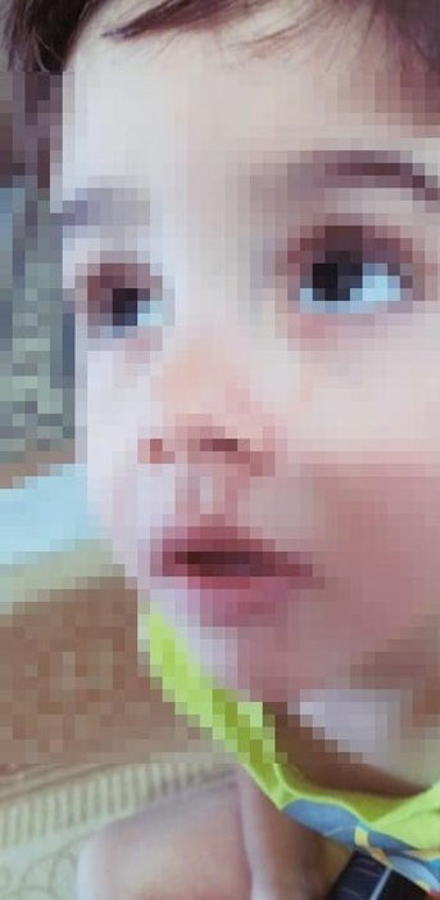 Canavar anne! 4 yaşındaki öz çocuğunun vücudunda sigara söndürmüş - Resim: 3