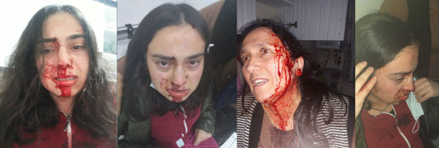 Anne Meryem Can ile kızı Kamer'in feryadı: Bizi öldürmeden önlem alın - Resim: 0