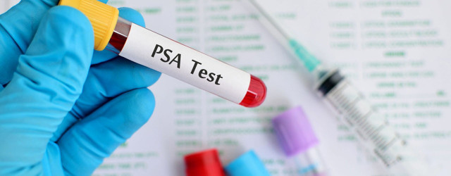 Uzmanı açıkladı! Prostat kanserinin tespiti için PSA testini önerdi - Resim: 2