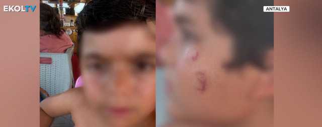 Denize giren korkunç halde çıkıyor! Hastaneler doldu taştı, nedeni belli oldu - Resim: 1