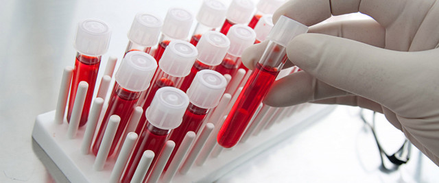 Okul öncesi sağlık kontrolleri sosyalleşme ve başarıyı arttırıyor - Resim: 3