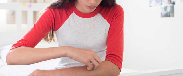 Prof. Dr. Nilgün Atakan: Her 4 kişiden birinde ürtiker hastalığı görülüyor - Resim: 4