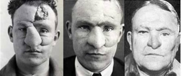 Dünyanın ilk estetik ameliyatları - Resim: 2