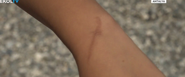 Denize giren korkunç halde çıkıyor! Hastaneler doldu taştı, nedeni belli oldu - Resim: 0