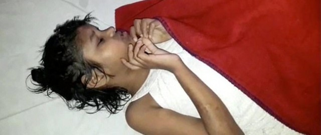 Engelli olduğu için ormana bırakıldı 8 yıl maymunlar büyüttü! - Resim: 1