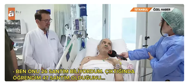 Türkiye'de bilinen en büyük vaka! Kendisi de doktorlar da inanamadı: "Şok geçirdim" - Resim: 2