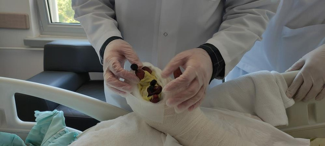 3 parmağını kaybetti ben bittim derken 12 saat sonra parmaklarını buldu - Resim: 2