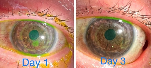 Apple iPhone 13 Pro Max ile göz muayenesi yapan doktor dünya genelinde gündem oldu - Resim: 0