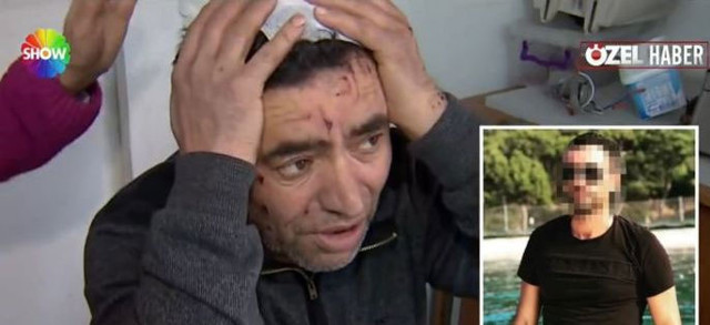 Böylesi daha önce olmadı! Amcasının kafa derisini yüzdü sebebi de... - Resim: 0