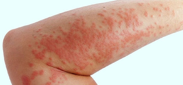 Egzamam var diye üzülmeyin! Öyle bir faydası çıktı ki çok şaşıracaksınız! - Resim: 0