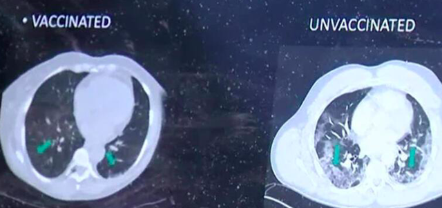 ABD'li doktorun paylaşımı aşı karşıtlarının iddiasını çökertti - Resim: 0