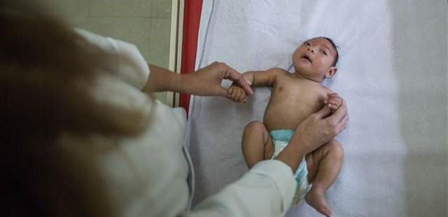 Sakat doğumlara neden olan virüs Türkiye'de mi? - Resim: 1