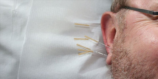 Alzaymırda depresyona akupunktur müjdesi - Resim: 1