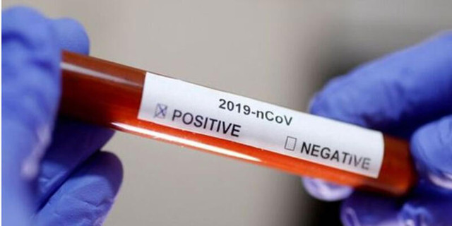 Corona virüs test kiti yasak ama kapış kapış satılıyor - Resim: 2