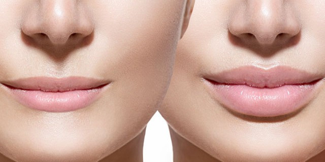 Dudak şekliniz karakterinizi ele veriyor eğer dolgunsa... - Resim: 1