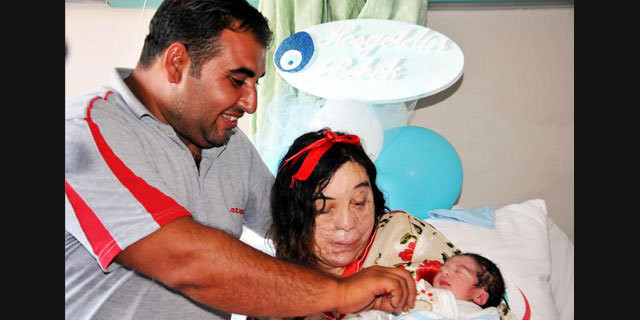 Yüz nakli beklerken bebek sahibi oldu - Resim: 2