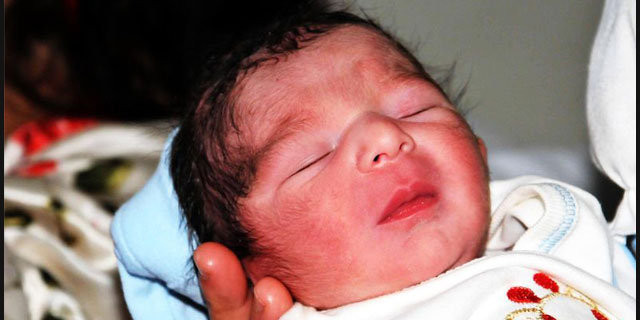 Yüz nakli beklerken bebek sahibi oldu - Resim: 3