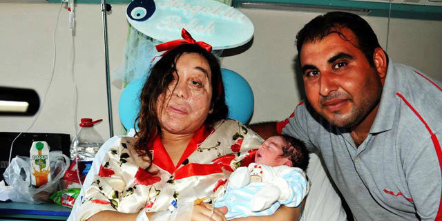 Yüz nakli beklerken bebek sahibi oldu - Resim: 4