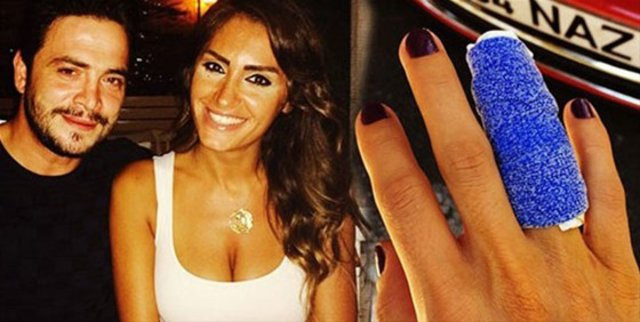 Ahmet Kural eski sevgilisinin de parmağını kırmış! - Resim: 4