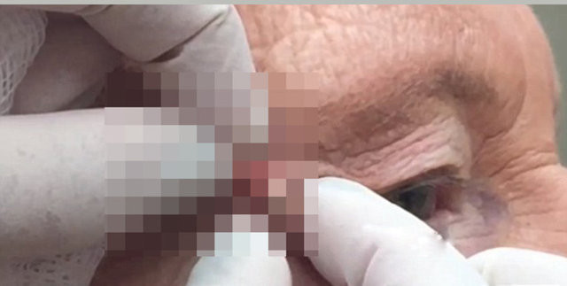 Siyah nokta sanıyordu bakın ne çıktı! - Resim: 1