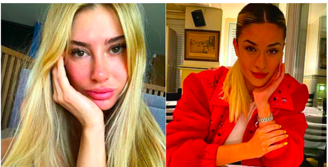 Acun Ilıcalı'nın sevgilisi Çağla Altunkaya estetiksiz eski haline bakın - Resim: 3