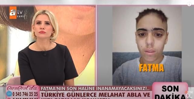 ATV Esra Erol'daki zihinsel engelli Fatma sevgilisi Ahmet, kuması ve onun sevgilisiyle yaşıyor! Rezalet! - Resim: 3