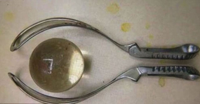 Eğlence için anüsüne öyle bir şey soktu ki hastanelik oldu! - Resim: 3