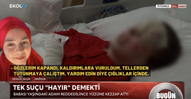 Karşılıksız aşk vahşeti! 60 yaşındaki adam 44 yaşındaki kadına kezzap atıp gözlerini kör etti - Resim: 1
