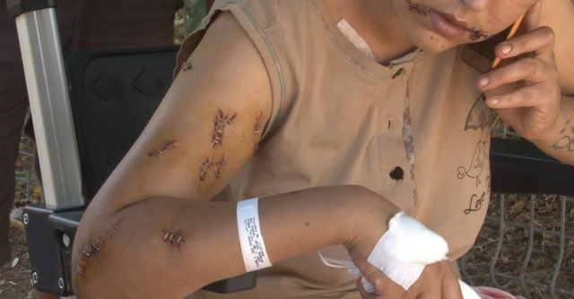 İzmir'de 104 yerinden bıçaklandı! Kanlar banyoyu doldurdu: Babamla aranda ne var? - Resim: 0