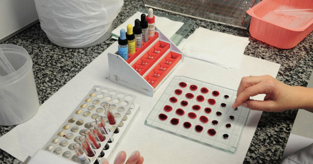 Bilim açık açık söyledi! Hangi kan grubuna sahip olanlar daha zekiymiş bakın - Resim: 0