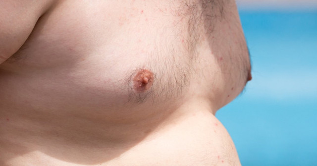 Erkeklerde memede yağlanma neden olur? Aman bu besinlerden uzak durun! - Resim: 0