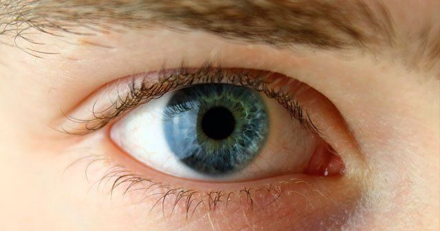 Gözde sinek uçuşması neden olur tedavisi var mı? - Resim: 1