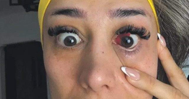 Fitness eğitmeni tavuk döner yedi! Gözü bu hale geldi - Resim: 1