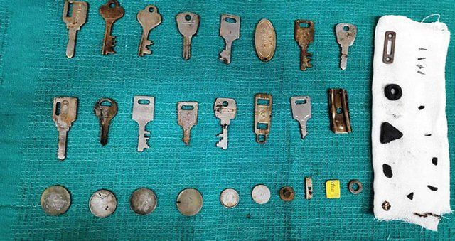 Doktorlar inanamadı midesinden tam 40 tane metal çıktı - Resim: 2