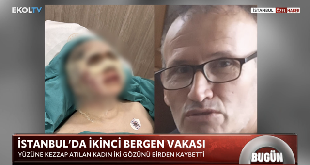 Karşılıksız aşk vahşeti! 60 yaşındaki adam 44 yaşındaki kadına kezzap atıp gözlerini kör etti - Resim: 2