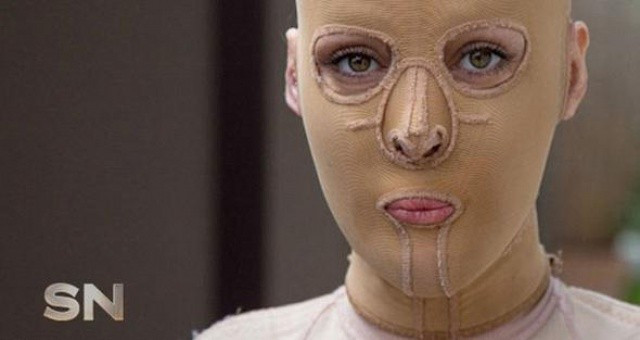 Kıskanç kadın yüzünü bu hale getirdi - Resim: 2