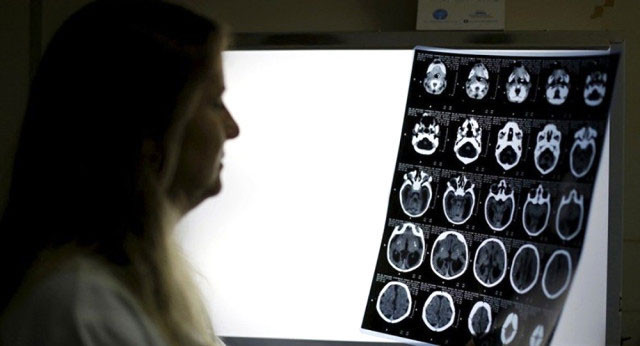 Polisler şoke oldu! Nefes almak için kafasına bıçak sapladı - Resim: 4