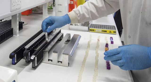 Koronovirüs İsrail'den sonra Lübnan'a da sıçradı! Ölümcül virüs bize artık çok yakın - Resim: 0