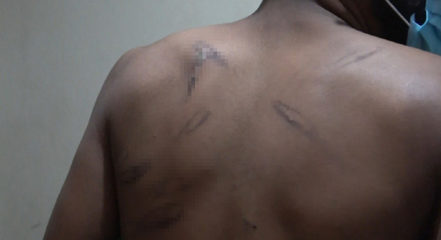 Yunan askeri göçmenlere 4 gün işkence etti: Türk askeri olmasa ölecektik! - Resim: 0