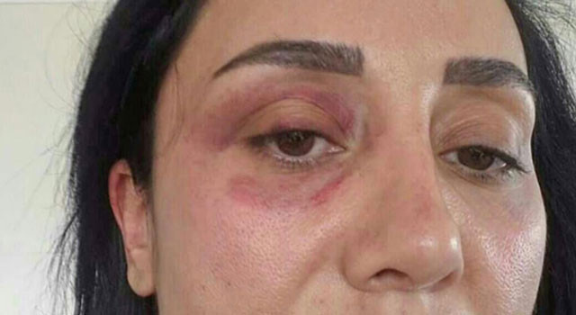 Sevgilisini darp eden ünlü oyuncu Saruhan Hünel için karar verildi  - Resim: 4