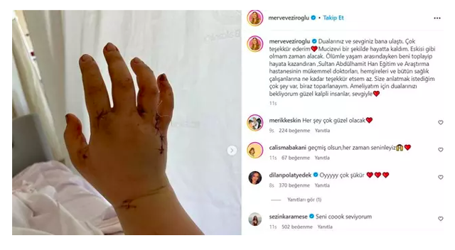 Eşi 32 yerinden bıçaklamıştı! Fenomen Merve Veziroğlu'ndan günler sonra ilk paylaşım - Resim: 0